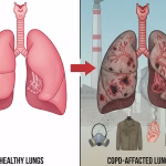 healthy lungs and COPD-affected lungs