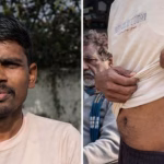 Debt Trap Leads to Kidney Trade in Cambodia: Chandrapur Farmer's Ordeal