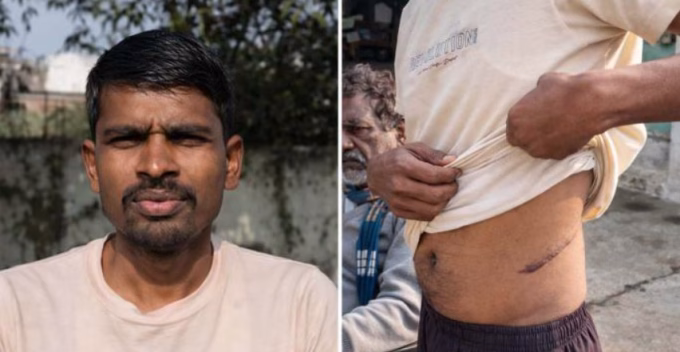 From Rs1 Lakh Debt to Kidney Sale: Shocking Farmer Exploitation Case