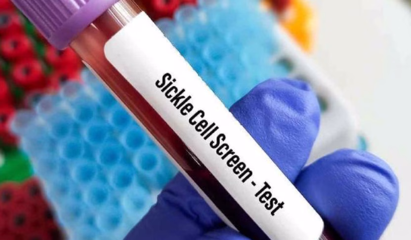 Arunodaya sickle cell campaign, Nagpur sickle cell screening